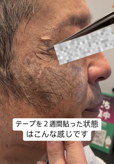 279558F5-B0D2-455C-A0A2-91AB514C244F