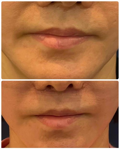 IMG_5115-e1765156200817