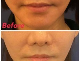 IMG_5323-e1774916706420