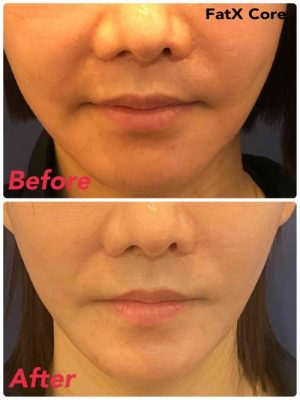 IMG_5323-e1774916706420