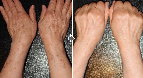 ffa2e19e950515470d21d84882209ecc